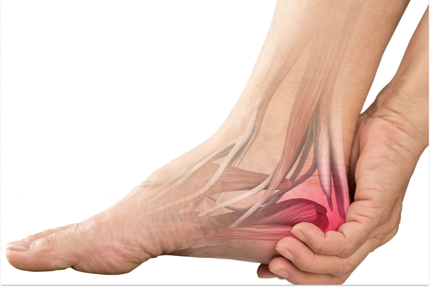 Heel Pain After Running: What Could Be the Cause? product