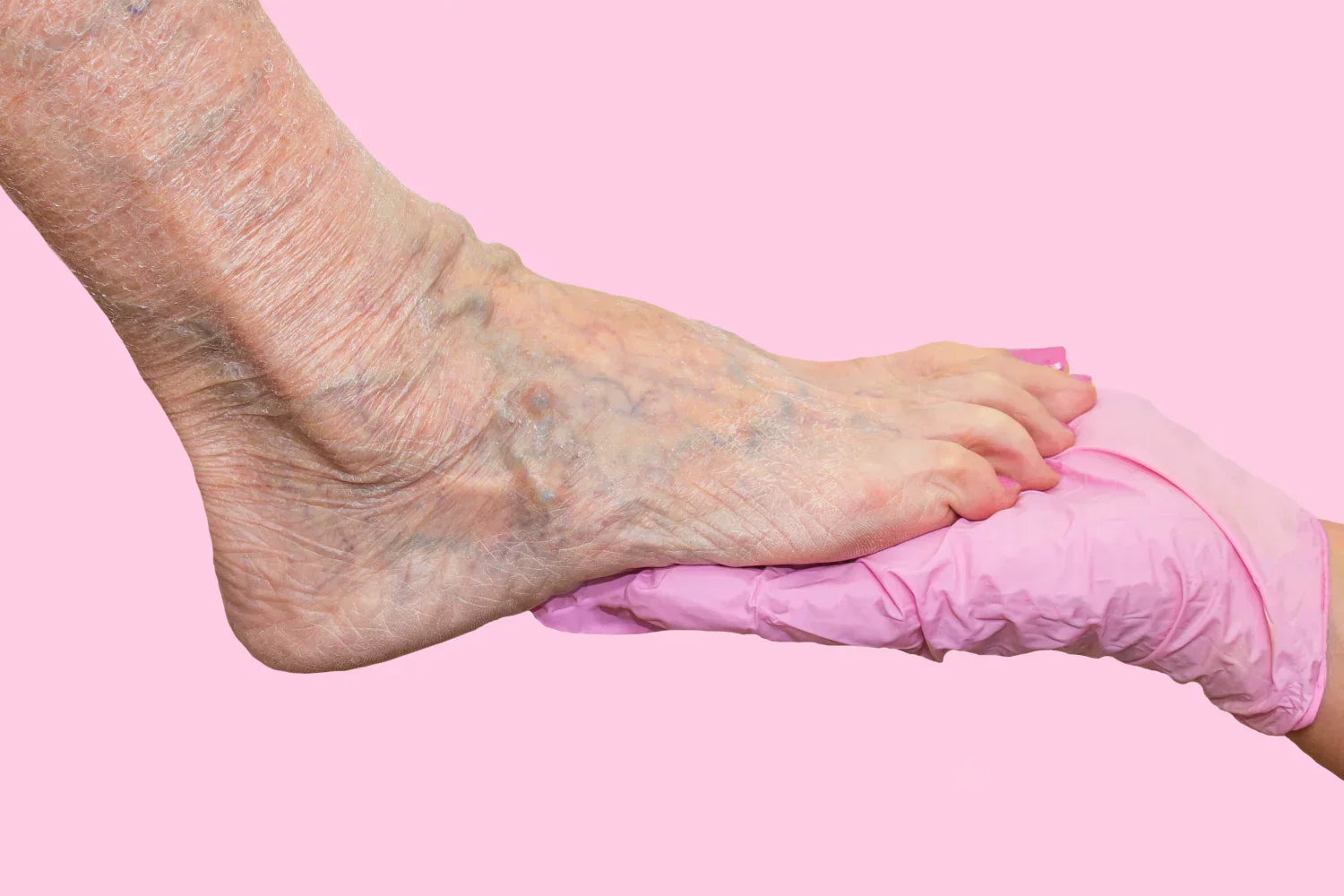 Arterial vs. Venous Insufficiency: What You Should Know product