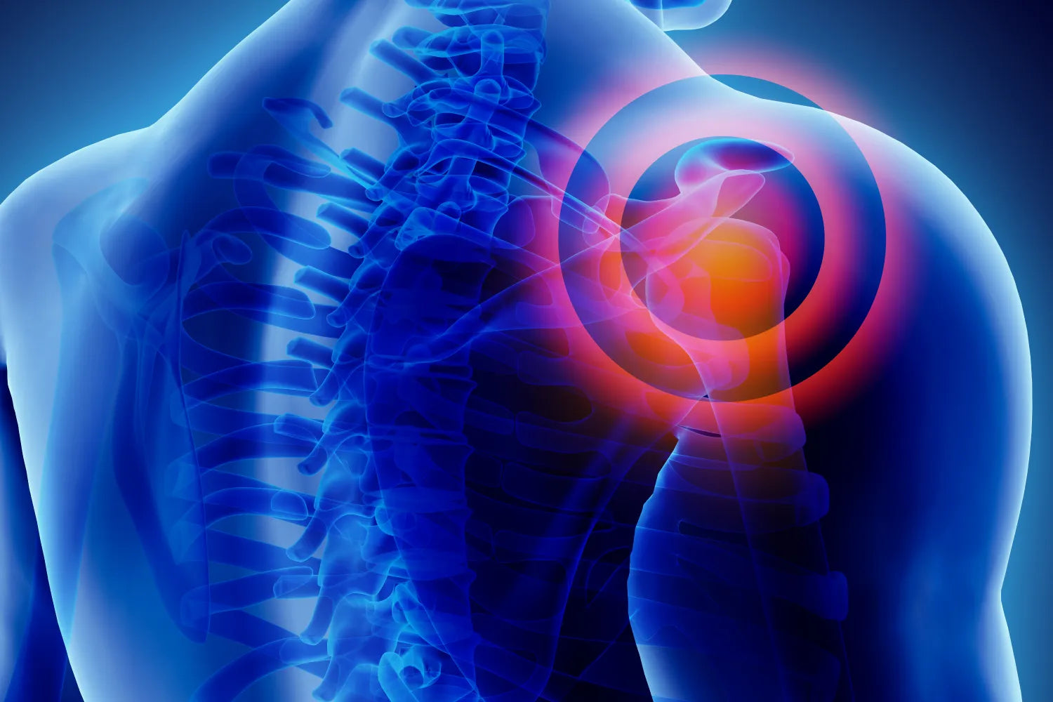 Shoulder Pain When Sleeping: 5 Common Reasons product