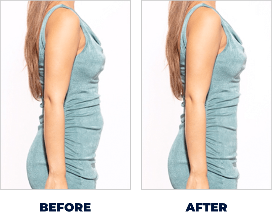 Before and After slide 2