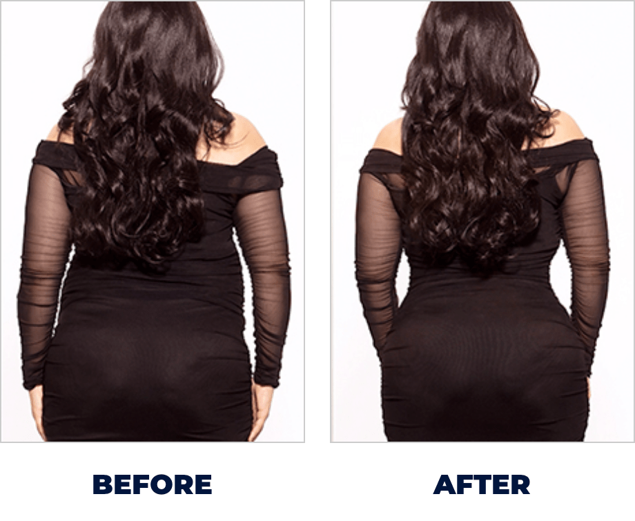 Before and After slide 3