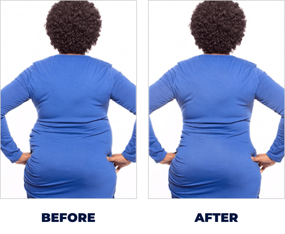 Before and After slide 4