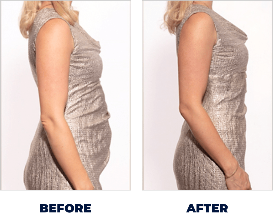 Before and After slide 5